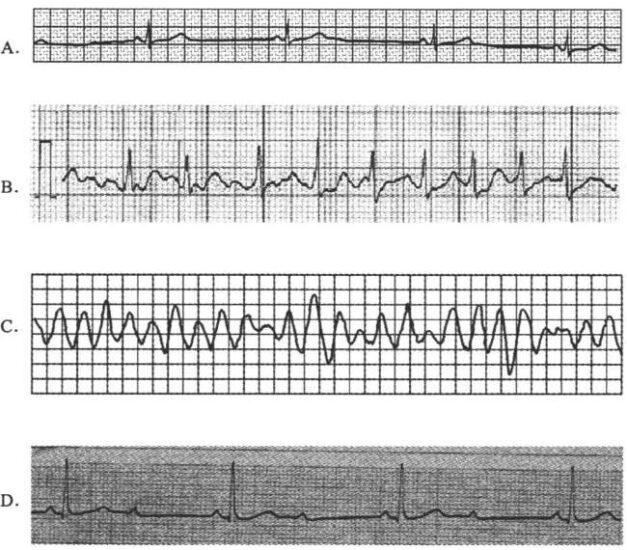 【真题】2020年8月自学考试03007急救护理学试题-自考菌